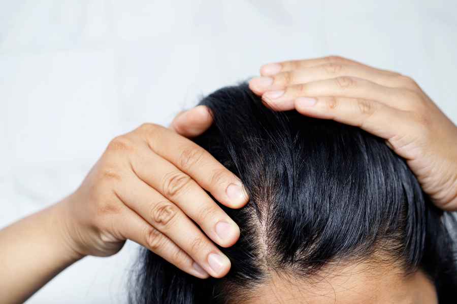 prodotti capelli grassi la saponaria